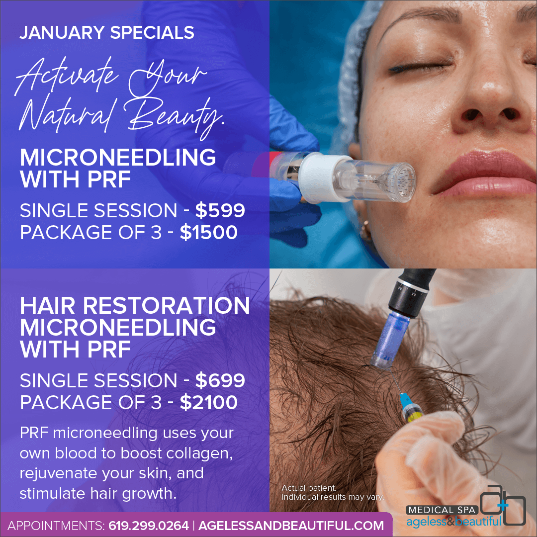 Microneedling with PRF Specials January - San Diego, CA