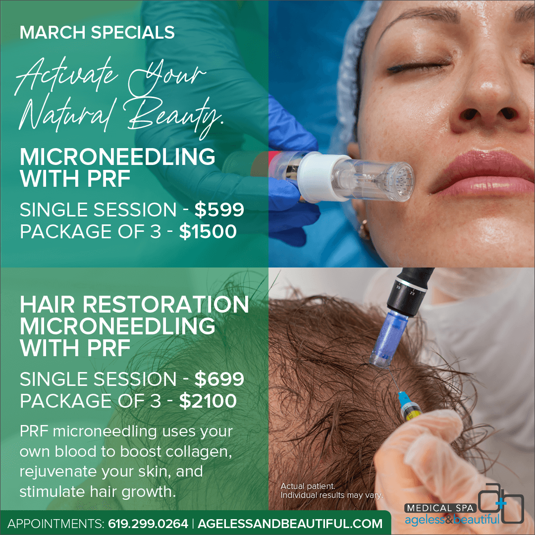 Microneedling with PRF Specials March - Ageless and Beautiful Med Spa - San Diego, CA