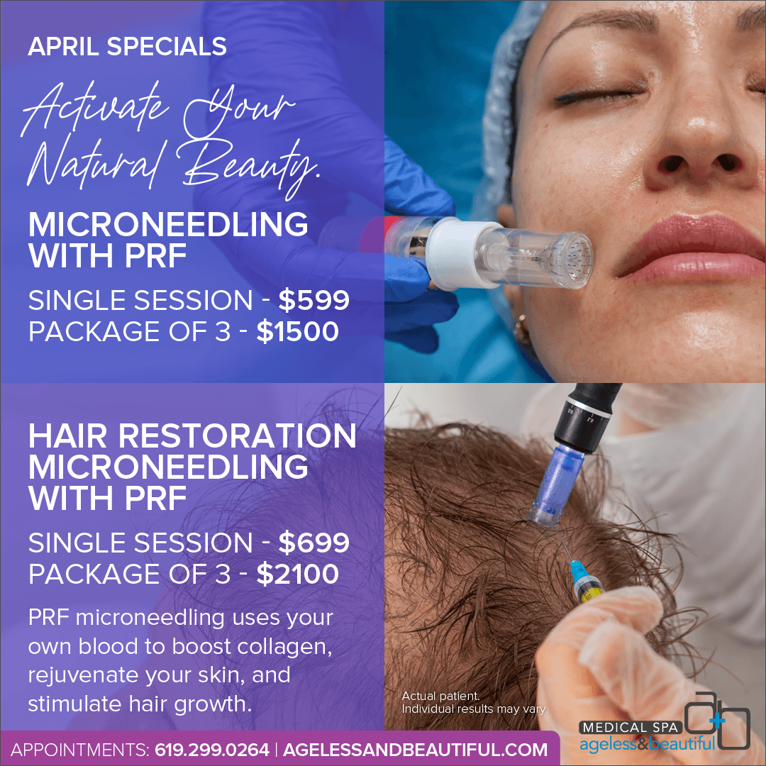 Microneedling with PRF Specials April - Ageless and Beautiful Med Spa - San Diego, CA