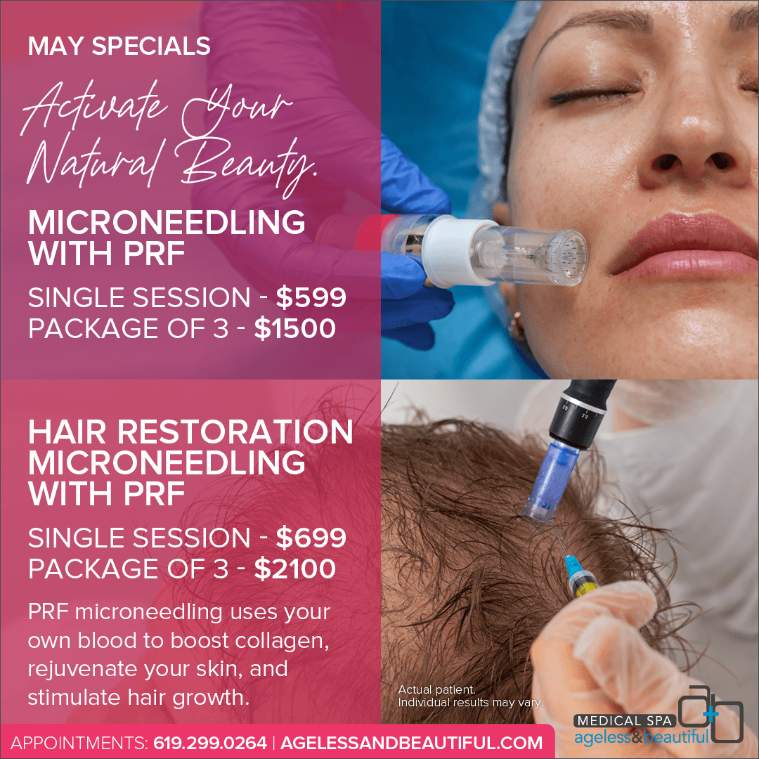 Microneedling with PRF Specials May - Ageless and Beautiful Med Spa - San Diego, CA